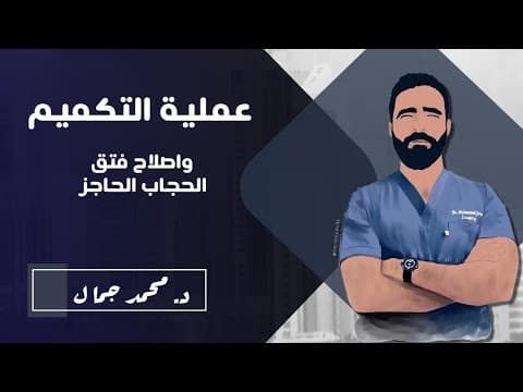 Complete sleeve gastrectomy with hiatal hernia repair — full unedited procedure